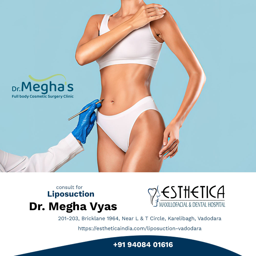 http://estheticaindia.com/wp-content/uploads/2022/11/liposuction-vadodaraArtboard-2.jpg