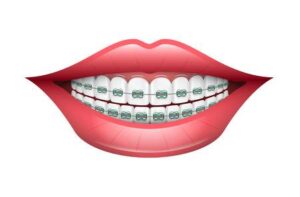 Best dentist vadodara, India