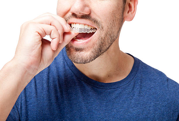 Teeth alignment 3 Best dentist vadodara, India