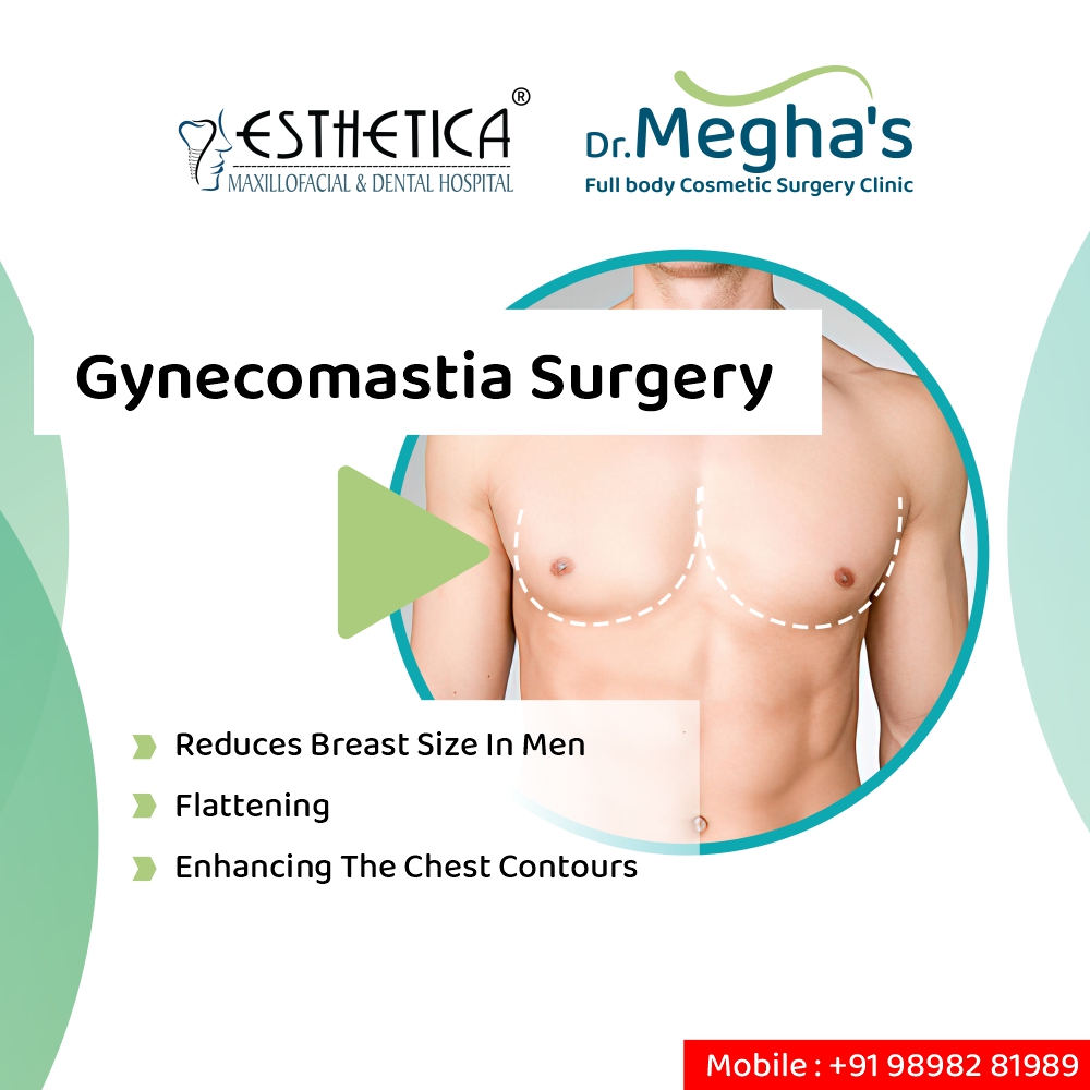 Gynaecomastia - treatment and surgery