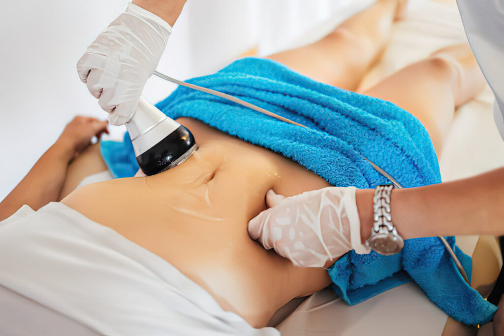 Liposuction can be a excellent method to rid yourself of the unwanted fats. 2 liposuction in vadodara 1 October 2025 Vadodara India