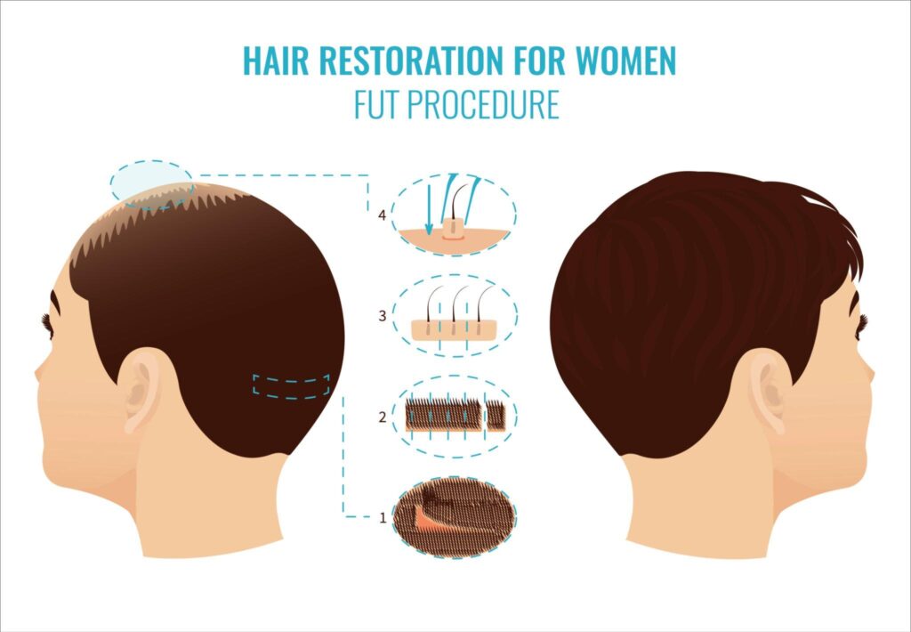 hair specialist in vadodara, dr megha vyas