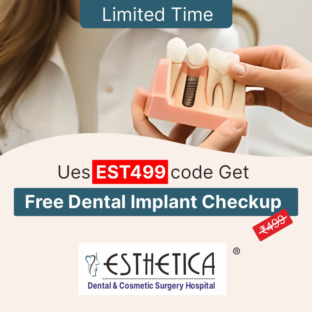 dental implants in vadodara