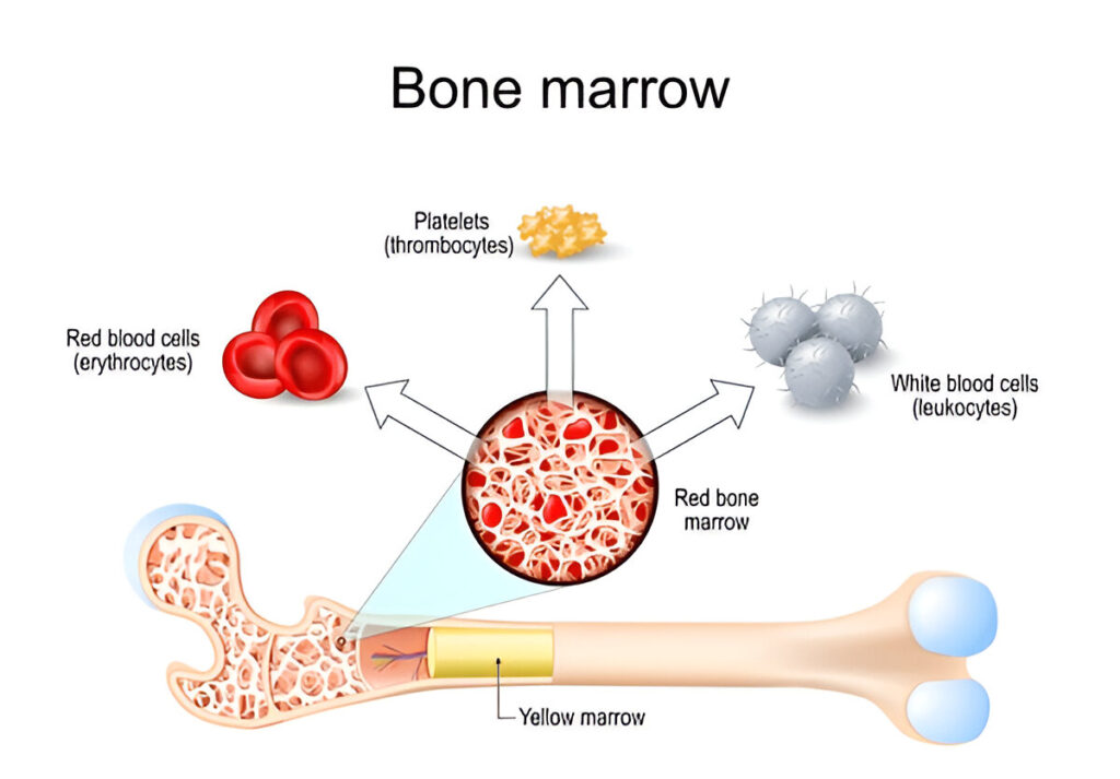 What is a Bone Marrow Aspirate Concentrate? 2 images April 2025 Vadodara India