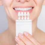 The Complete Guide to Beautiful Dental Veneers in Vadodara 14 360 F 501561883 VOQqitU69XIOImirYA7cyA4UZMHeUbs1 October 2025 Vadodara India