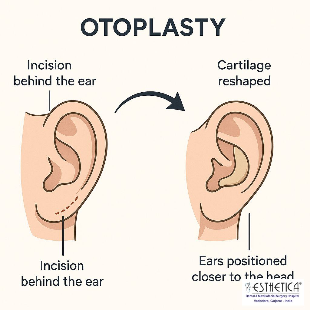 Otoplasty November 2025 Vadodara India