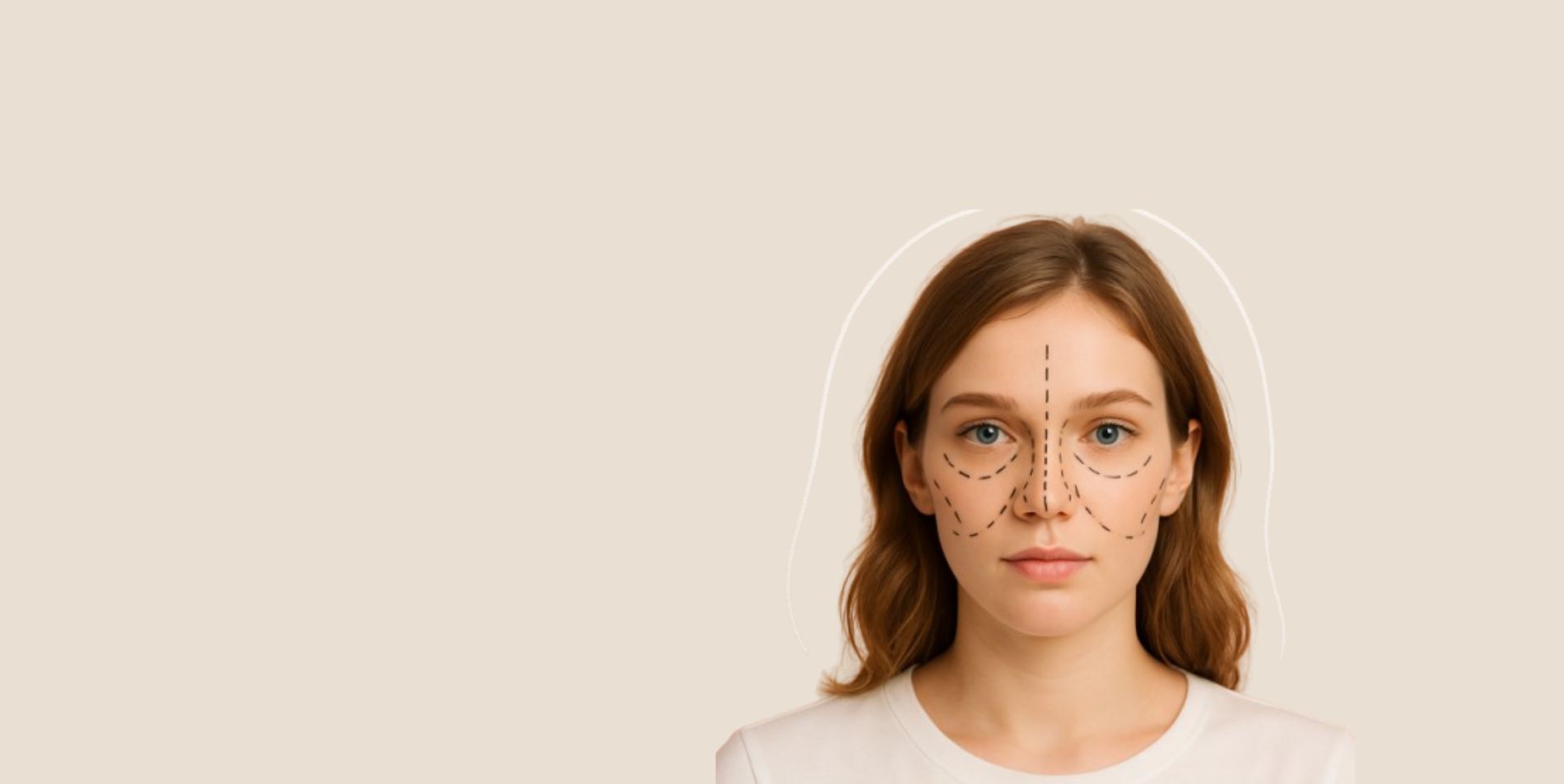 Rhinoplasty 1 November 2025 Vadodara India